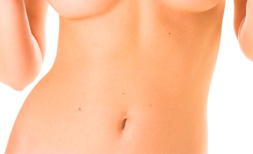 Abdominoplastia
